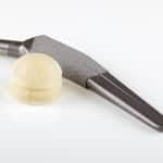 DePuy Hip Replacement Devices have caused serious complications