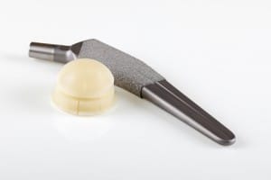 DePuy Metal Hip Replacement Devices have caused serious complications