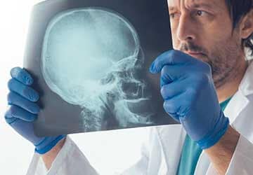 Traumatic Brain Injury Accidents in Columbia