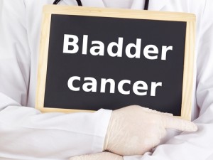 Actos bladder cancer
